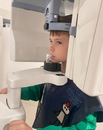 Menino com avental de proteção posicionado no aparelho de radiografia panorâmica.